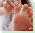 Bunion Surgery New Brunswick